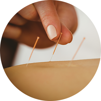 Custom Physical Therapy Acupuncture